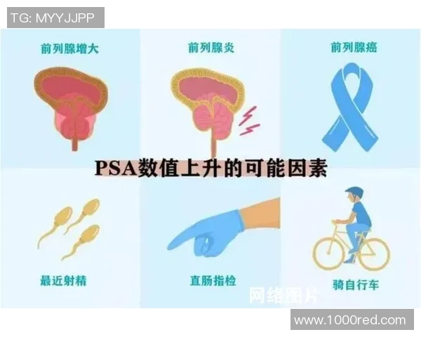 患前列腺癌,前纽卡门将:一年前已承受手术,但癌仍是在分散